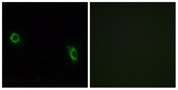 a18808 or6j1 primary antibodies if testing 1
