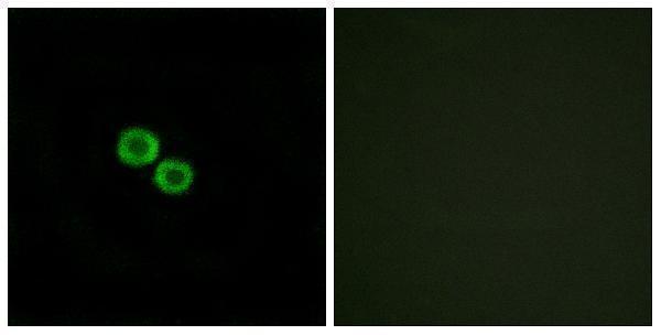 a18812 or8k3 primary antibodies if testing 1