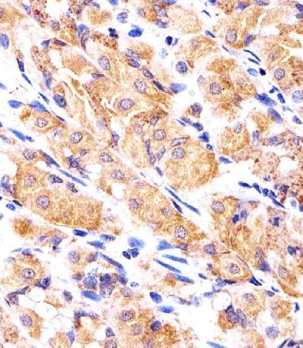 Immunohistochemical analysis of paraffin-embedded H