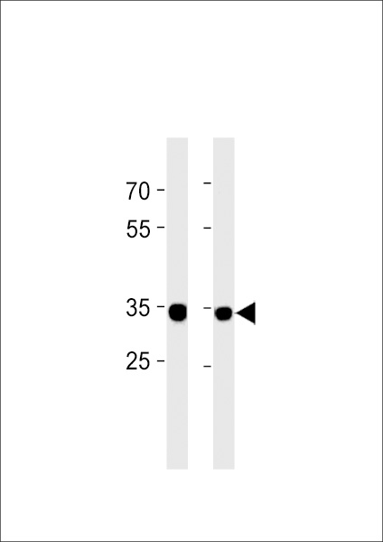RPLP0P6 Antibody (N-term) western blot analysis in U251，PC-3 cell line lysates (35ug/lane)