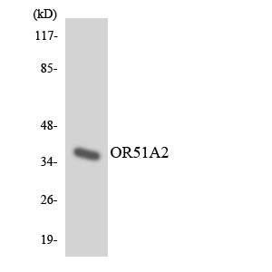 Western blot analysis of the lysates from COLO205 cells using OR51A2 antibody
