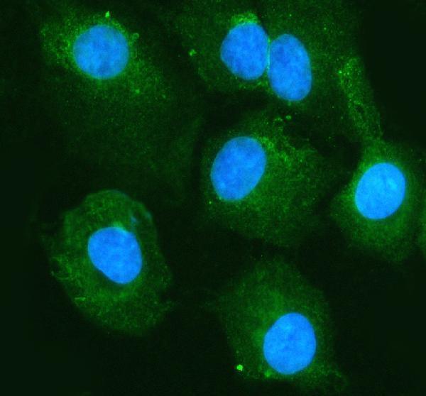 a18877 1 slco1b7 primary antibodies if testing 1