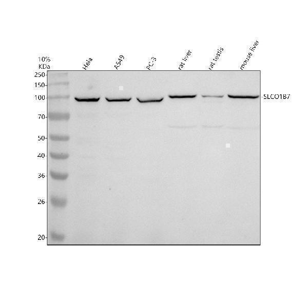 a18877 1 slco1b7 primary antibodies wb testing 1