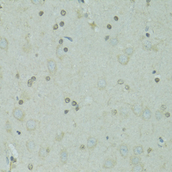 a19016 gtf2h2c primary antiboties ihc testing 2