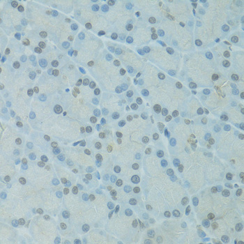 a19016 gtf2h2c primary antiboties ihc testing 3