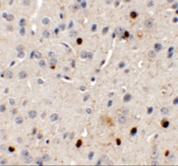 a19152 spryd3 primary antibodies ihc testing 2