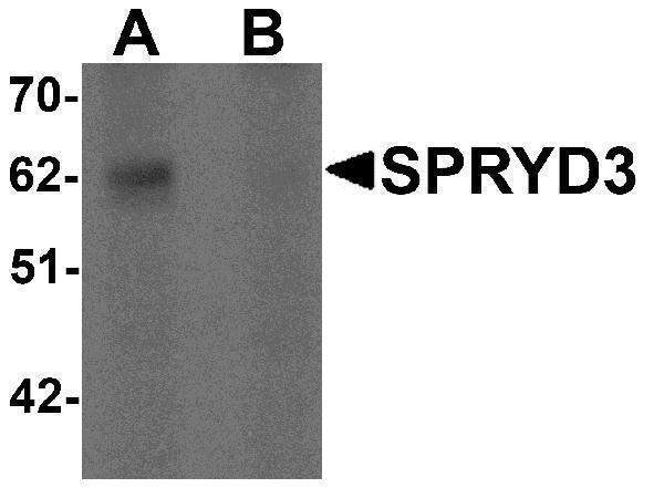 a19152 spryd3 primary antibodies wb testing 1