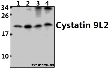 a19234 1 cst9lp1 primary antiboties wb testing 1