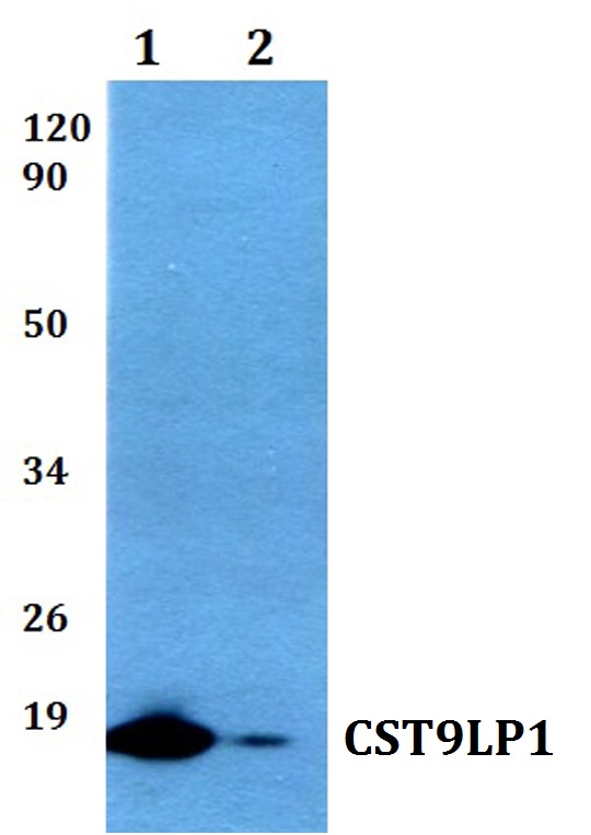 Western blot (WB) analysis of CST9LP1 polyclonal antibody at 1:500 dilution
Lane1:HEK293T whole cell lysate
Lane2:PC12 whole cell lysate 