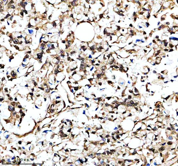 IHC analysis of LINC00470 using anti-LINC00470 antibody (A19331)