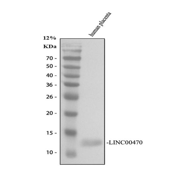 Western blot analysis of LINC00470 using anti-LINC00470 antibody (A19331)