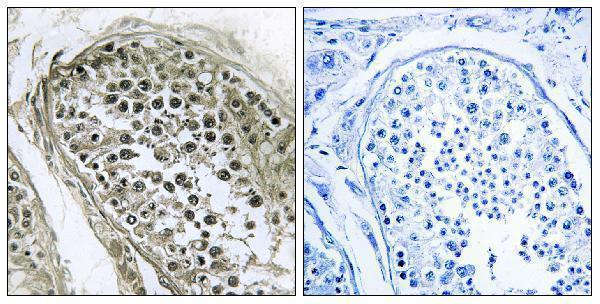 a19486 gab4 primary antibodies ihc testing 1