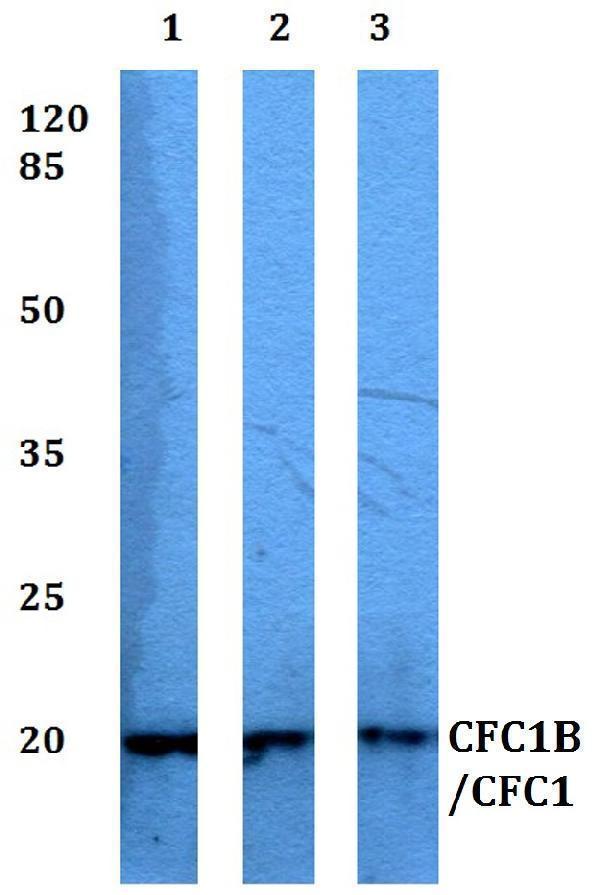 Western blot (WB) analysis of CFC1B/CFC1 polyclonal antibody at 1:500 dilution
Lane1:HEK293T whole cell lysate
Lane2:Raw264