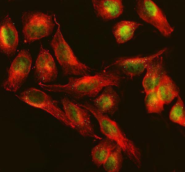  IF analysis of TTC34 using anti-TTC34 antibody (A19531-1) and anti-Beta Tubulin antibody (M01857-3)