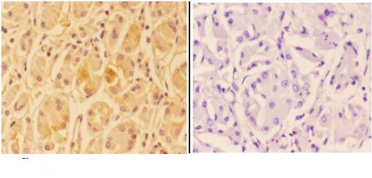 a19555 1 ankrd20a3 primary antiboties ihc testing 2