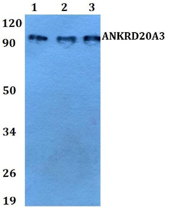 a19555 1 ankrd20a3 primary antiboties wb testing 1