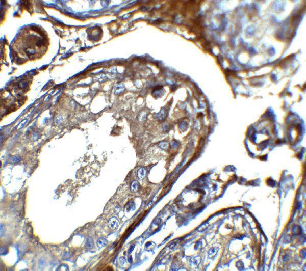 a19642 iqcf2 primary antibodies ihc testing 2