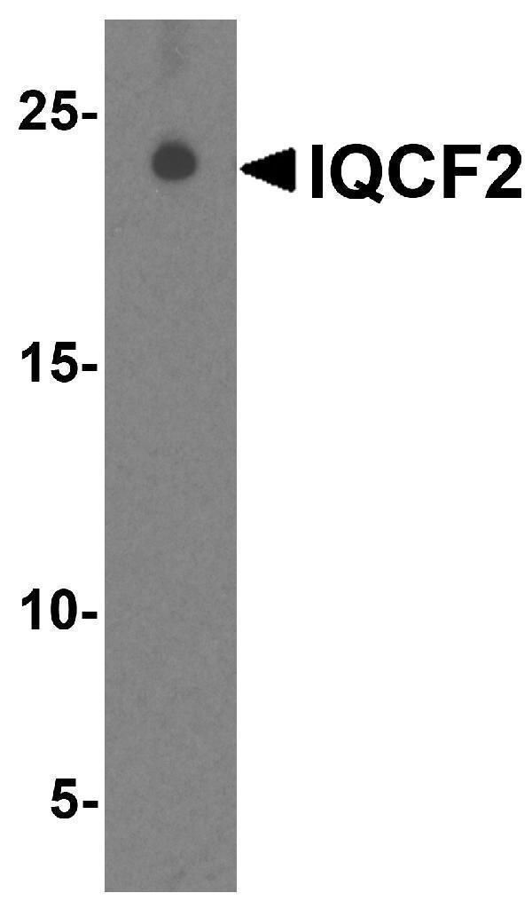 a19642 iqcf2 primary antibodies wb testing 1