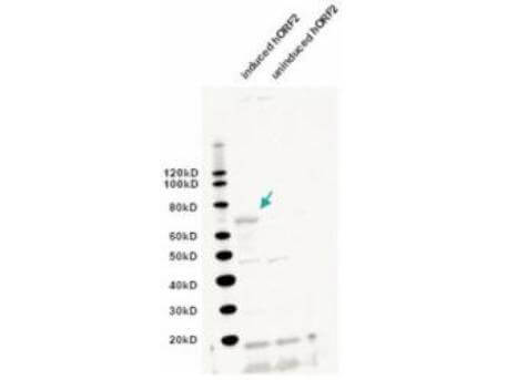 a19762 orf2 primary antibodies wb testing 1