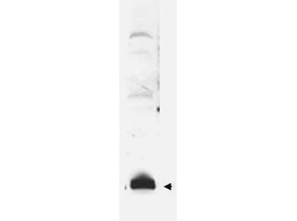 Western blot of hSUMO fusion protein