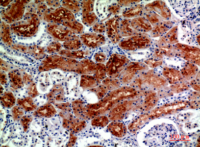 Immunohistochemical analysis of paraffin-embedded human-kidney, antibody was diluted at 1:200