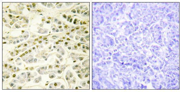 a20019 rad51b primary antibodies ihc testing 1