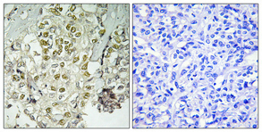 a20020 rad51d primary antibodies ihc testing 1