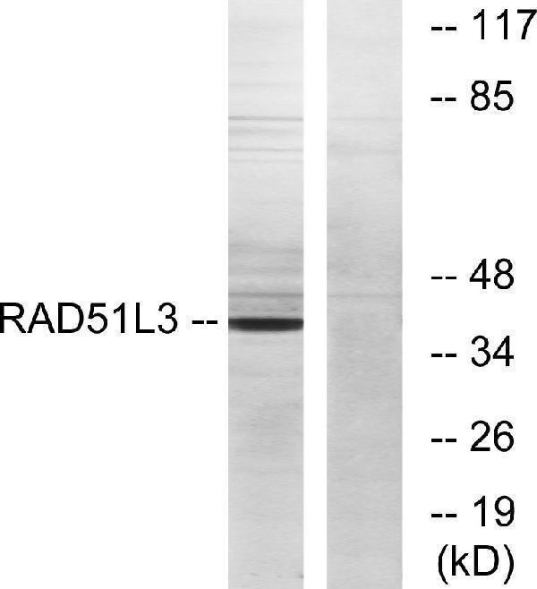 a20020 rad51d primary antibodies wb testing 2