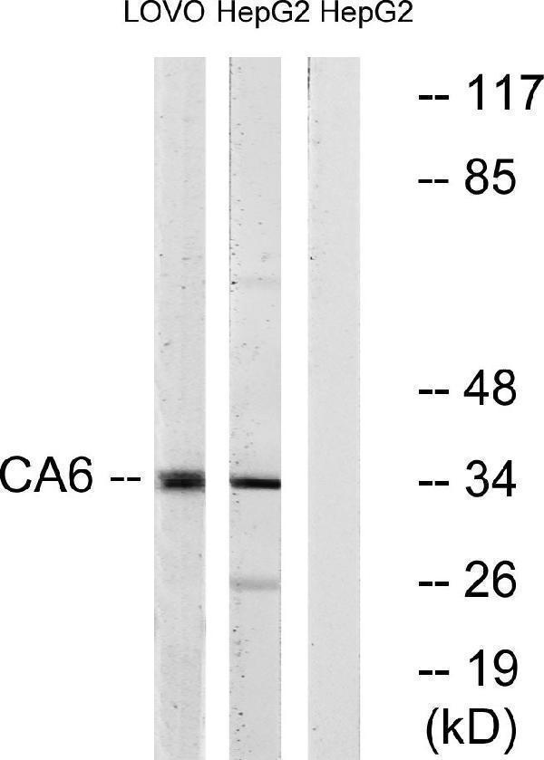 Western blot analysis of lysates from HepG2, and LOVO cells, using CA6 Antibody