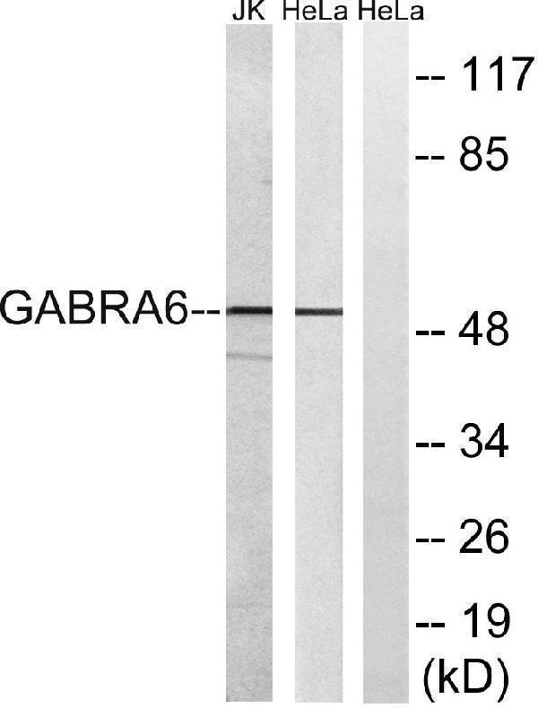 a30101 gabra6 primary antibodies wb testing 3