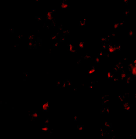 a30172 morf4 primary antibodies if testing 3