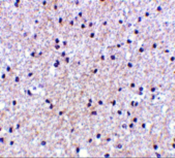 a30172 morf4 primary antibodies ihc testing 2
