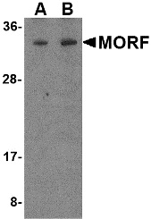 a30172 morf4 primary antibodies wb testing 1