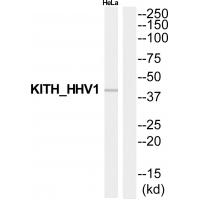 Western blot analysis of extracts from HeLa cells, using KITH_HHV1 antibody A30422.