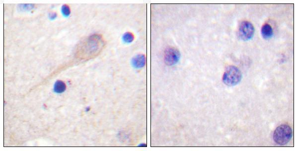 a30434 park2 primary antibodies ihc testing 1