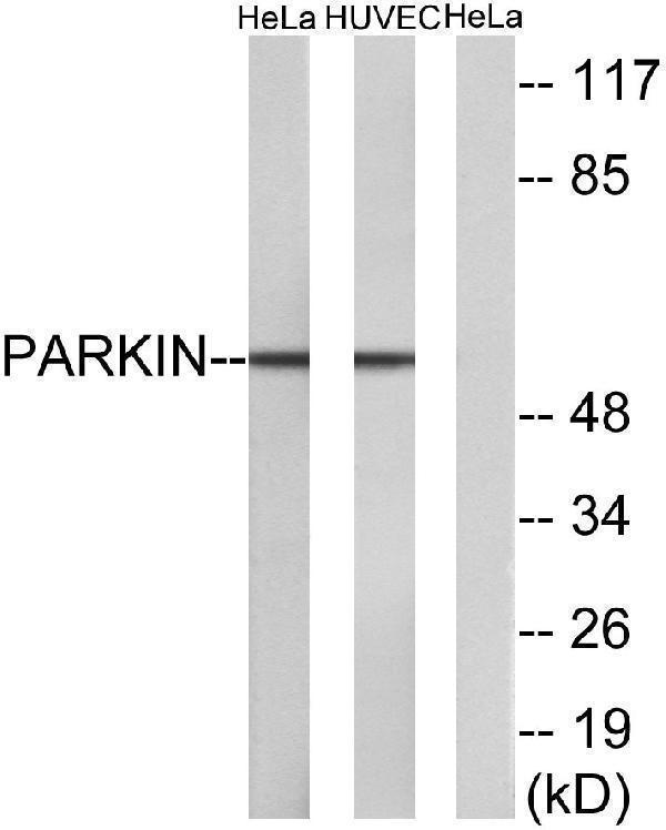 a30434 park2 primary antibodies wb testing 3