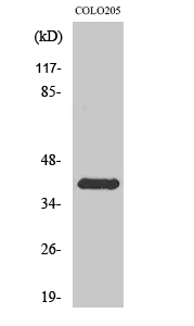 Western Blot analysis of various cells using Rhodopsin Polyclonal Antibody