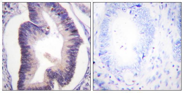 a30440 pfkfb2 primary antibodies ihc testing 1
