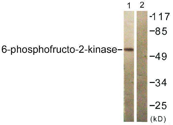 a30440 pfkfb2 primary antibodies wb testing 3