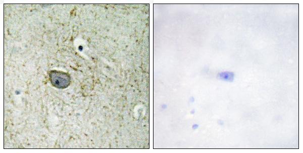 a30446 pdgfra primary antibodies ihc testing 2