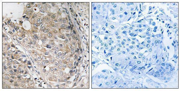 a30451 dusp1 primary antibodies ihc testing 1