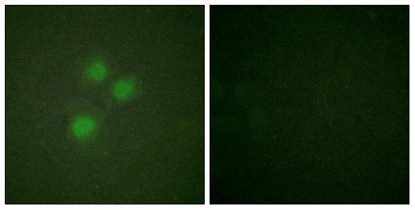 a30452 nifk primary antibodies if testing 1