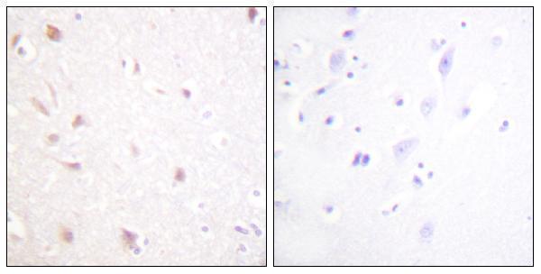a30452 nifk primary antibodies ihc testing 2