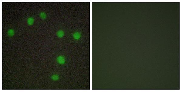 a30461 nkx6 3 primary antibodies if testing 1