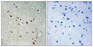 a30462 nemf primary antibodies ihc testing 1