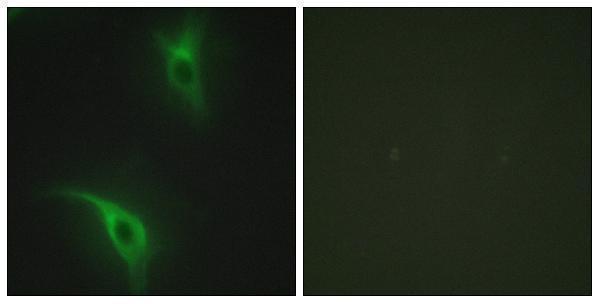 Immunofluorescence analysis of HeLa cells, using CKS1 Antibody