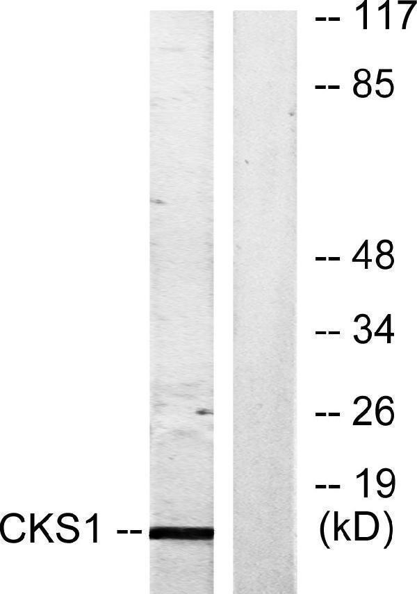 Western blot analysis of lysates from Jurkat cells, treated with serum 20% 15