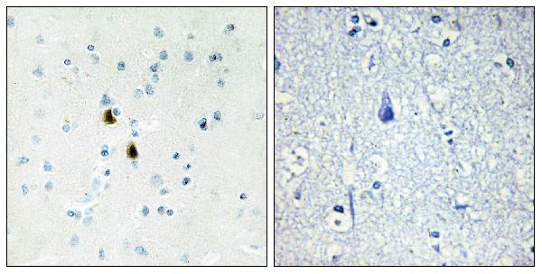 a30465 pkia primary antibodies ihc testing 2