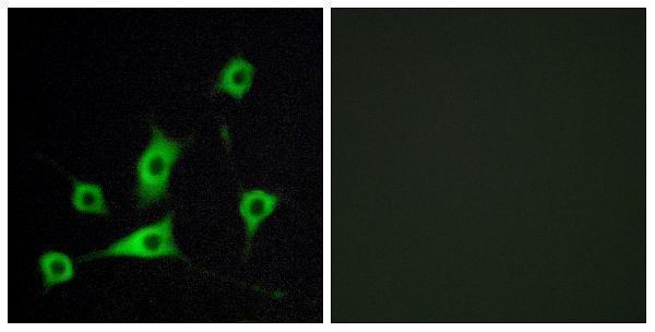 a30467 rbp5 primary antibodies if testing 1