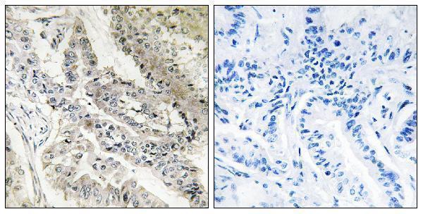 a30467 rbp5 primary antibodies ihc testing 2